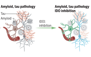 Science：一種抗癌藥物有望治療阿爾茨海默病