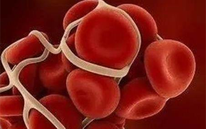 胃蛋白酶原II（PGII）-磁微?；瘜W發(fā)光法（AE/AP）/熒光免疫層析解決方案（含保護劑評估）