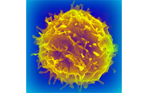 干細(xì)胞移植會增加癌癥風(fēng)險(xiǎn)嗎？