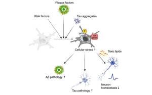 《Neuron》阿爾茨海默氏癥背后隱藏的罪魁禍?zhǔn)祝猴@微鏡下看小膠質(zhì)細(xì)胞
