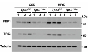 《Nature》脂肪肝為什么會導(dǎo)致肝癌？
