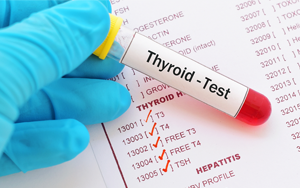  總及游離三碘甲狀腺原氨酸（TT3及FT3）-磁微?；瘜W發(fā)光法（AE/AP）/熒光免疫層析解決方案（雙抗體夾心法）