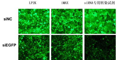 穩(wěn)定表達(dá)GFP的HeLa-EGFP細(xì)胞，沉默siEGFP，48h后熒光拍照
