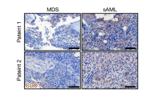 Nature：牛磺酸能推動白血病癌細胞生長！