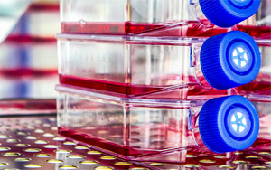 生物制藥與疫苗生產(chǎn)中的細(xì)胞培養(yǎng)全流程解決方案