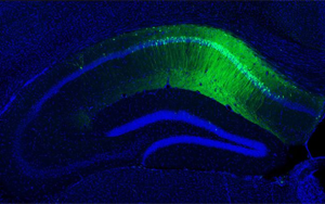 5-羥色胺(5-HT)通過(guò)調(diào)節(jié)腸道菌群-免疫軸改善加速度暴露誘導(dǎo)的大鼠腸腦軸功能障礙及認(rèn)知損傷