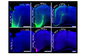 小鼠內(nèi)臟運動皮層神經(jīng)網(wǎng)絡(luò)的精細解析與功能調(diào)控機制研究