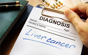 原發(fā)性肝癌檢測用AFU底物(CNP-AFU和M-G-CNP-AFU)