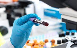 【FAPGG】，血管緊張素轉(zhuǎn)換酶檢測用底物