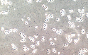 如何破解細(xì)胞培養(yǎng)中支原體污染難題