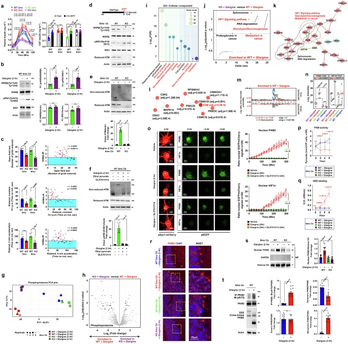 胰島素激活的ATM調(diào)控小腦中需氧糖酵解的關(guān)鍵調(diào)控因子 胰島素激活的ATM調(diào)控小腦中需氧糖酵解的關(guān)鍵調(diào)控因子