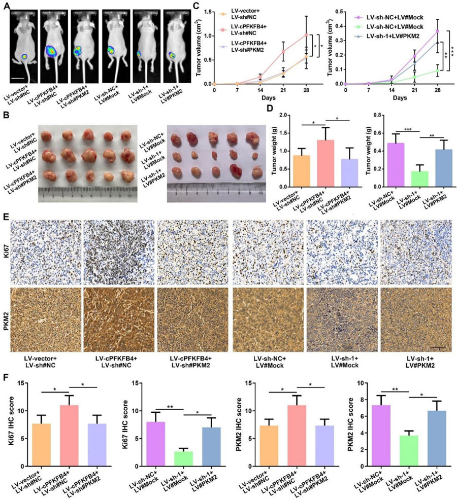 cPFKFB4通過PKM2促進(jìn)胰腺癌惡性進(jìn)展