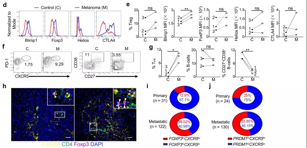 如何重塑腫瘤微環(huán)境，強化抗PD-1療效？Treg細胞的Blimp1表達是關鍵！