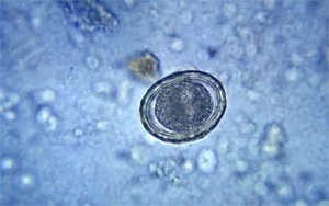 讓培養(yǎng)皿“患上”PTSD，然后為人類拓寬治療手段