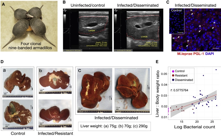麻風分枝桿菌促進成年九帶犰狳體內(nèi)正常肝臟器官生長而無肝損傷 麻風分枝桿菌促進成年九帶犰狳體內(nèi)正常肝臟器官生長而無肝損傷