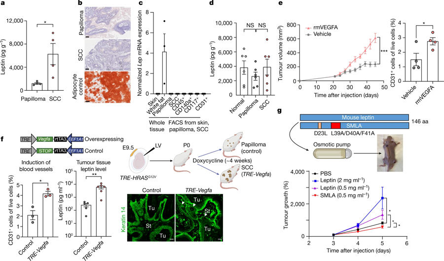 惡性腫瘤微環(huán)境中瘦素水平升高，是由血管生成增加引起的