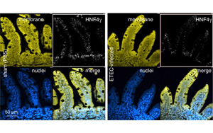 某些形式的兒童營(yíng)養(yǎng)不良和發(fā)育遲緩可以通過疫苗預(yù)防