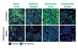 加州伯克利大學(xué)發(fā)現(xiàn)“病毒毒素”可導(dǎo)致重癥COVID-19
