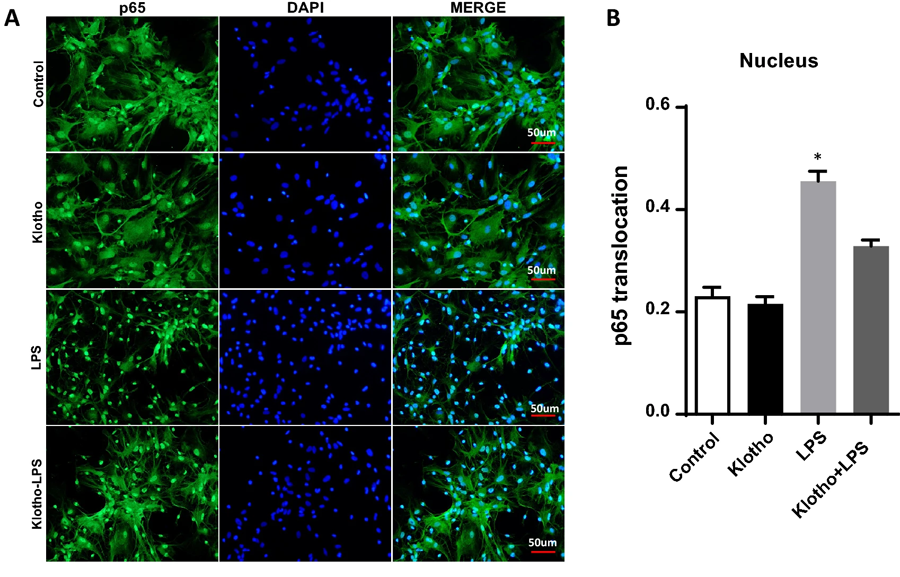α-Klotho挽救核心區(qū)域由LPS誘導的NF-κB活化 α-Klotho挽救核心區(qū)域由LPS誘導的NF-κB活化