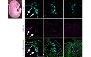 《Nature》淋巴系統(tǒng)潛在的新功能——造血！
