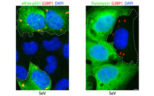 肺細(xì)胞如何保護(hù)自己免受RNA病毒感染？
