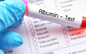 白蛋白（ALB）檢測試劑盒用原輔料