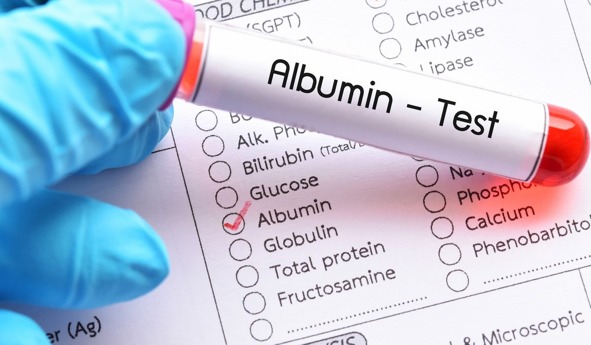 白蛋白檢測 白蛋白檢測