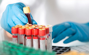 血氨（BA）檢測試劑盒用原輔料