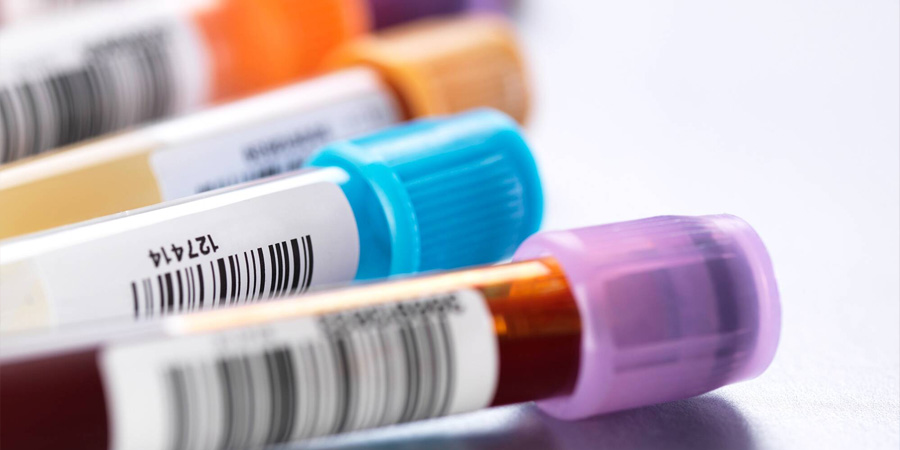 前蛋白檢測(cè) 前蛋白檢測(cè)