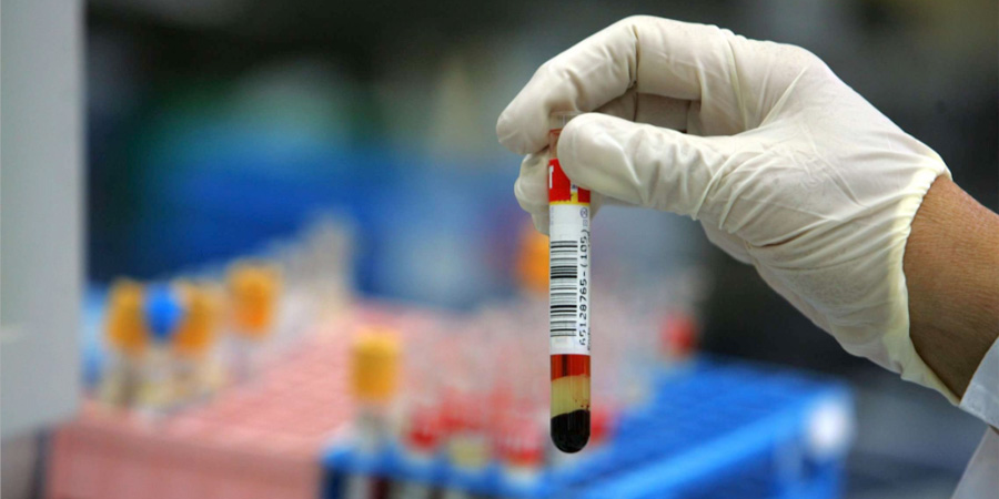 前蛋白檢測 前蛋白檢測