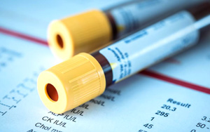 谷胱甘肽還原酶（GR）檢測試劑盒用原輔料