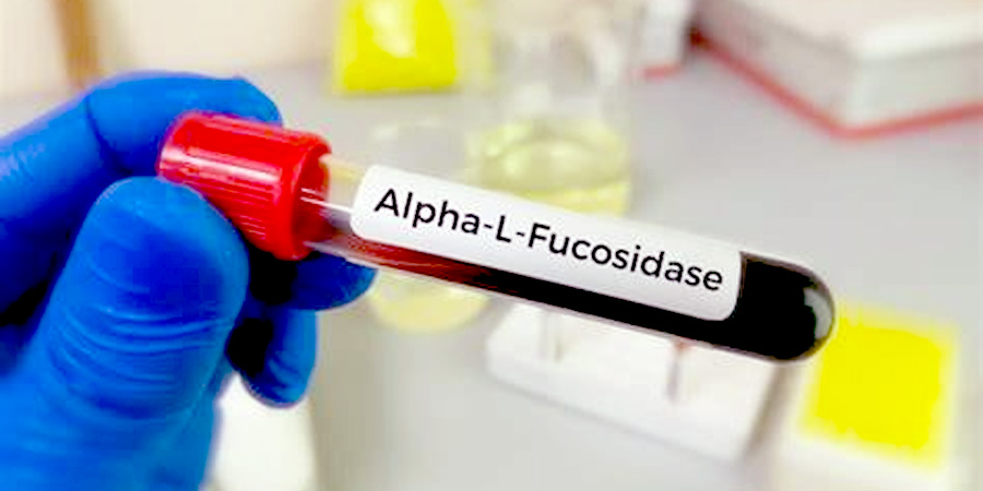 前蛋白檢測(cè) 前蛋白檢測(cè)