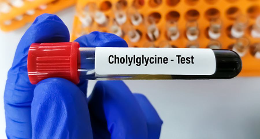 總膽汁酸(TBA)檢測 總膽汁酸(TBA)檢測