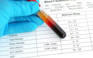 谷丙轉(zhuǎn)氨酶（ALT）檢測(cè)試劑盒用原輔料