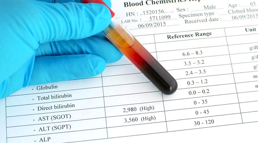 谷丙轉(zhuǎn)氨酶(ALT)檢測(cè) 谷丙轉(zhuǎn)氨酶(ALT)檢測(cè)