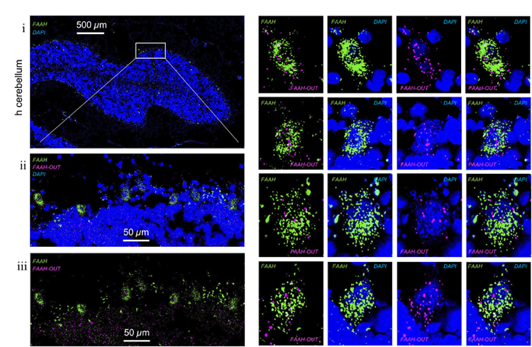 FAAH和FAAH-OUT RNA在人腦組織細胞中的表達水平和定位 FAAH和FAAH-OUT RNA在人腦組織細胞中的表達水平和定位