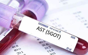 谷草轉(zhuǎn)氨酶（AST/GOT）檢測(cè)試劑盒用原輔料