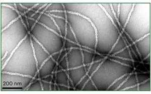 一個高度不穩(wěn)定的蛋白質(zhì)導(dǎo)致神經(jīng)退化