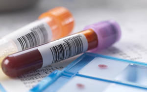 α2-巨球蛋白檢測(cè)試劑盒用原輔料