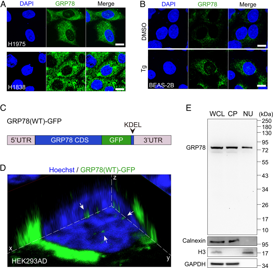 GRP78定位于人癌癥細(xì)胞和內(nèi)質(zhì)網(wǎng)應(yīng)激細(xì)胞的細(xì)胞核。