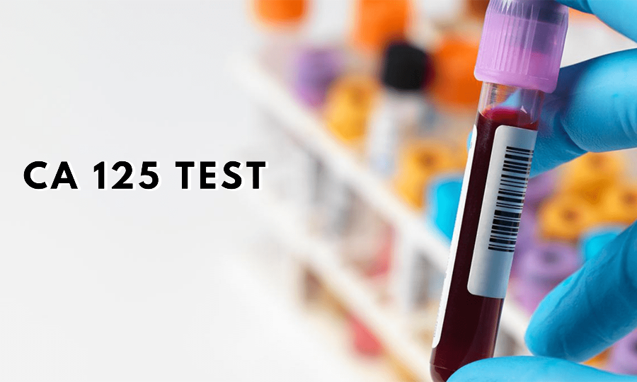 HP免疫層析 HP免疫層析