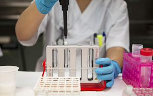 糖鏈抗原19-9(CA19-9)-磁微?；瘜W(xué)發(fā)光（吖啶酯）解決方案