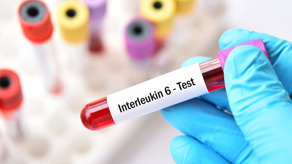 IL-6磁微?；瘜W(xué)發(fā)光熒光免疫層析