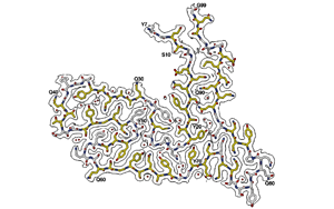令人驚訝的蛋白質(zhì)導(dǎo)致早期癡呆