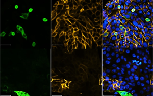Nature最新研究表明，一類新的抗病毒藥物可以對抗SARS-CoV-2