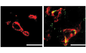 Nature子刊：肝臟中的免疫細(xì)胞會對高膽固醇水平做出反應(yīng)，并吃掉多余的膽固醇